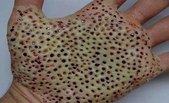 Ellerinde, birden bire birşeyler çıkmaya başladı