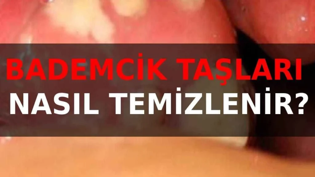 Bademcik taşı nasıl temizlenir