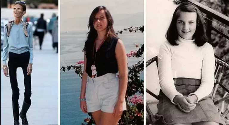 Dünyanın En İnce Kadınının Anoreksiyaya Karşı Verdiği Savaş