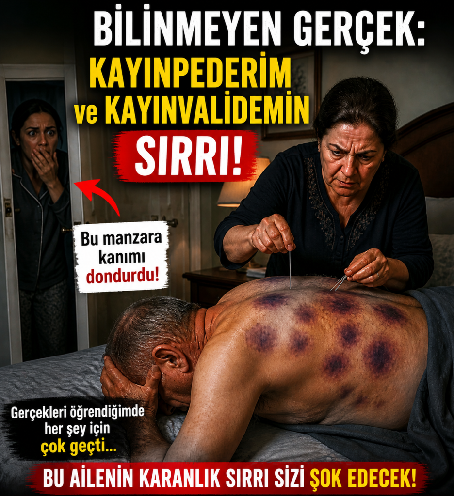 Kayınpederimin Sırtındaki Mavi İzler… Kazara Düşme mi, Yoksa Çok Daha Korkunç Bir Gerçek mi?